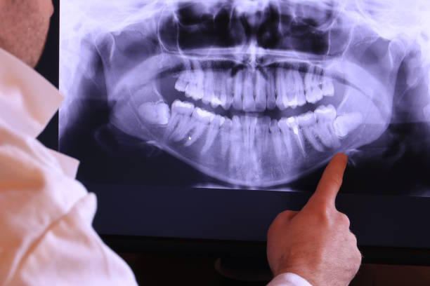 Best Broken or Cracked Tooth Emergency Dentist in Amelia Court House, VA